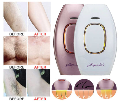 Optixer™ Handheld Laser Hair Removal Device